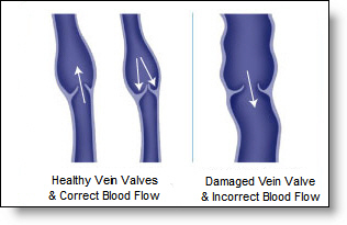Vein Therapy  Prota Clinic